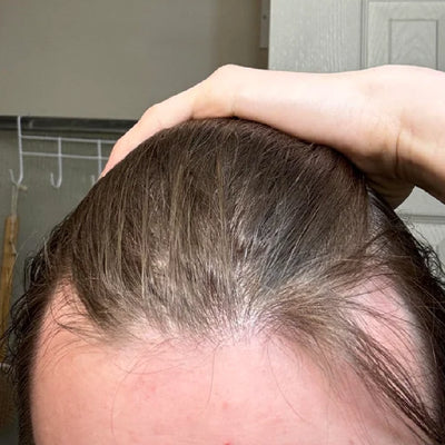 cabello que se quiebra